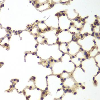 Glutathione Synthetase (GSS) Rabbit pAb (APR20084N)